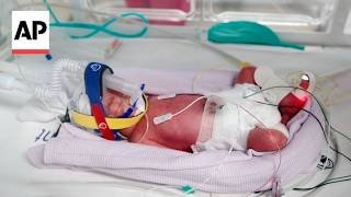 Australian mother of four gives birth to identical quadruplet girls