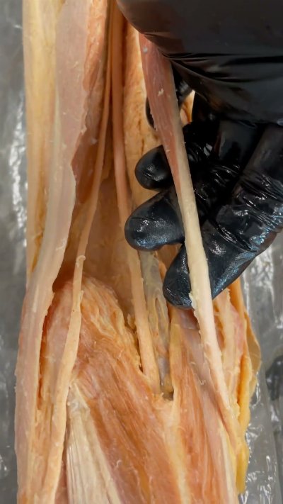 Examining Cadaver Hamstrings