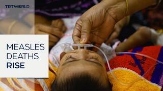 Bangladesh measles outbreak kills nearly 750 people since March